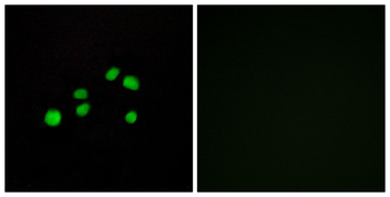 Collagen XXIII α1 Antibody