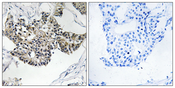 RSAD1 Antibody