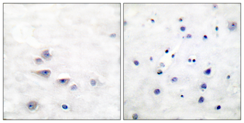 Shc (Phospho-Tyr427) Antibody