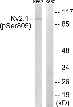 Kv2.1 (Phospho-Ser805) Antibody