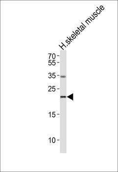 IFNW1 Antibody