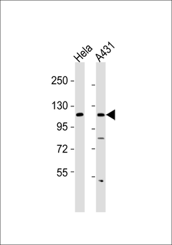 Collagen 1 alpha 2 Antibody