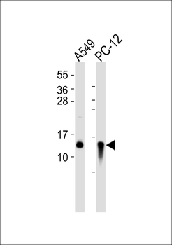 Cystatin B Antibody