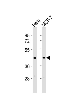 TGF beta 1 Antibody