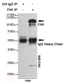 FAK Antibody