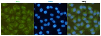 FAK Antibody
