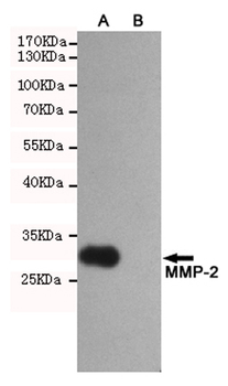 MMP-2 Antibody