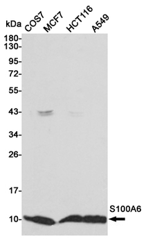 S100A6 Antibody