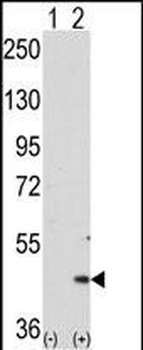 MAPKAPK2 Antibody (N-term)