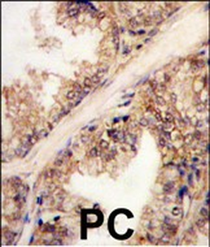 PRMT4 Antibody (C-term)