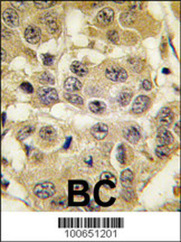 SENP2 Antibody (N-term)