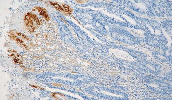 COL4A1 Antibody