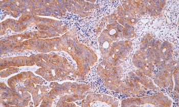 FLT1 Antibody