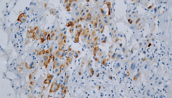 HBcAg Antibody