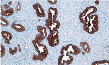 PSAP Antibody