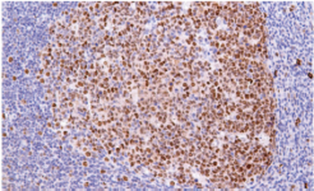 SPI1 Antibody