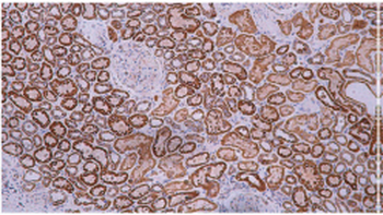 STAT6 Antibody