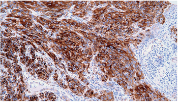 TUBB3 Antibody