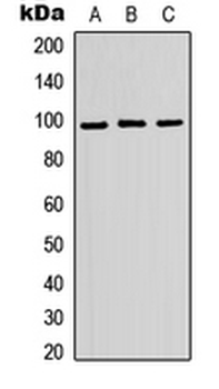 ATP6V0A2 Antibody