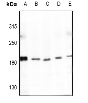 Collagen 4 alpha 4 Antibody