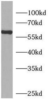CGAS Rabbit Polyclonal Antibody