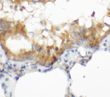 CGAS Rabbit Polyclonal Antibody