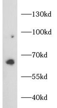 SATB2 Rabbit Polyclonal Antibody