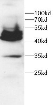 CD36 Rabbit Polyclonal Antibody