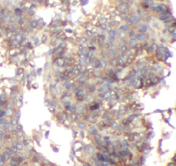 CD36 Rabbit Polyclonal Antibody