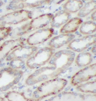 HCN1 Rabbit Polyclonal Antibody