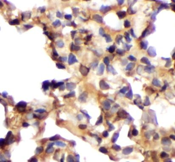 PRF1 Rabbit Polyclonal Antibody