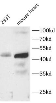 CFHR3 Rabbit Polyclonal Antibody