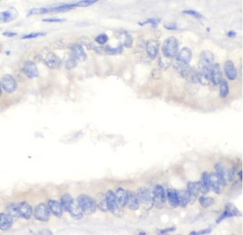 CFHR3 Rabbit Polyclonal Antibody