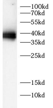 PPP1R15A Rabbit Polyclonal Antibody