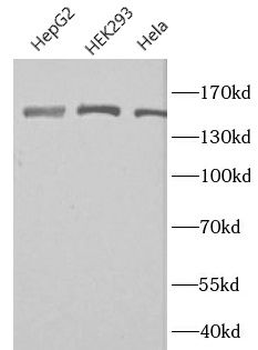 DSG2 Rabbit Polyclonal Antibody