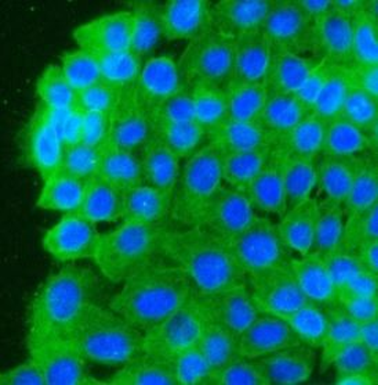 DSG2 Rabbit Polyclonal Antibody