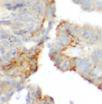 DSG2 Rabbit Polyclonal Antibody