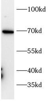 CADM1 Rabbit Polyclonal Antibody