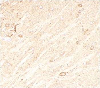 CADM1 Rabbit Polyclonal Antibody