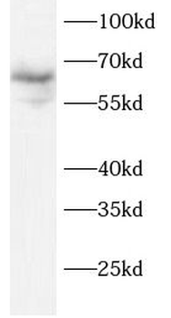 VSIG1 Rabbit Polyclonal Antibody
