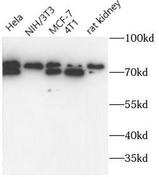 LPP Rabbit Polyclonal Antibody
