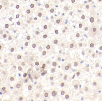 LPP Rabbit Polyclonal Antibody