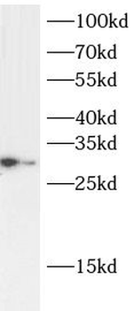 APOD Rabbit Polyclonal Antibody