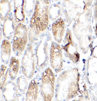 APOD Rabbit Polyclonal Antibody