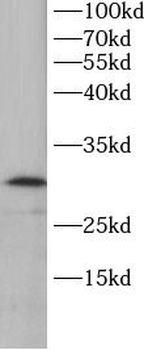TK1 Rabbit Polyclonal Antibody