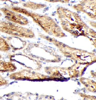 TK1 Rabbit Polyclonal Antibody
