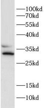 HAX1 Rabbit Polyclonal Antibody