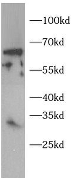 TWIST1 Rabbit Polyclonal Antibody