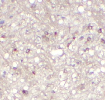 TWIST1 Rabbit Polyclonal Antibody