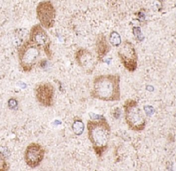RTN1 A Rabbit Polyclonal Antibody